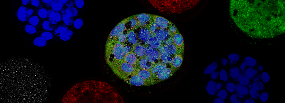 Confocal fluorescence microscopy of cells